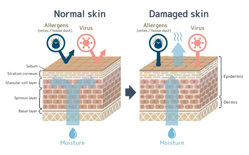 Damaged Skin Barrier Here S How To Repair It Mamabella