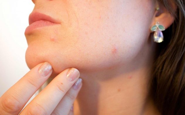 Get rid of spots fast and get rid of blemishes