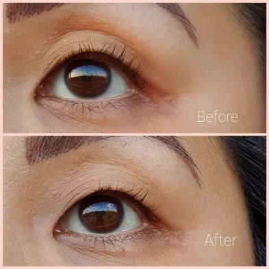 The Ordinary Caffeine Solution before and after
