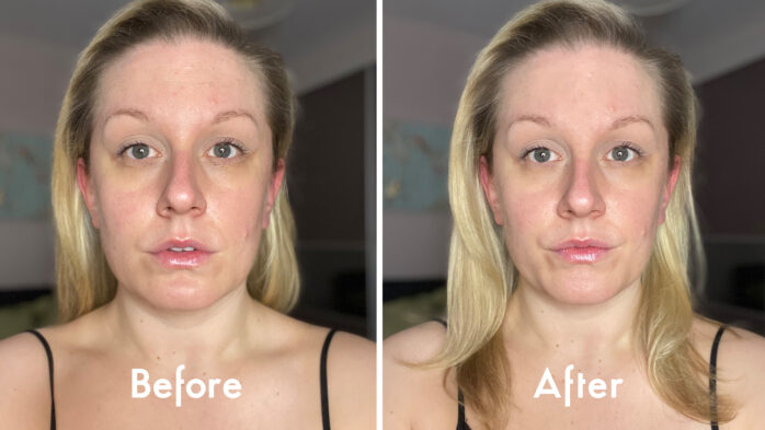 Oia Skin patches review face before and after
