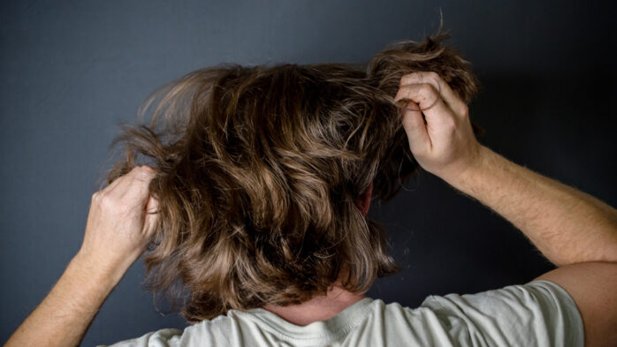  Hair-pulling-conditions-men-and-women