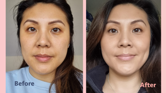 Before and After FOREO Iris review