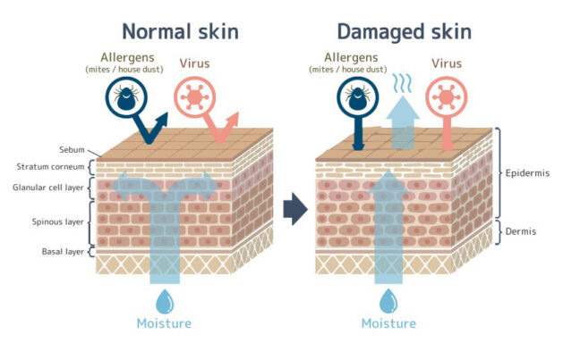 Damaged skin barrier and how to repair it